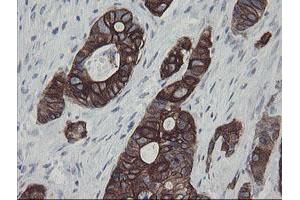 Image no. 6 for anti-Src-like-adaptor 2 (SLA2) antibody (ABIN1500949) (SLAP2 anticorps)