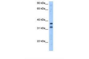 Image no. 1 for anti-Tripartite Motif Containing 13 (TRIM13) (AA 51-100) antibody (ABIN324386) (TRIM13 anticorps  (AA 51-100))