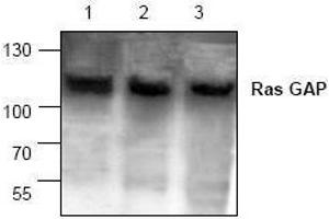 Image no. 1 for anti-RAS P21 Protein Activator (GTPase Activating Protein) 1 (RASA1) antibody (ABIN127081) (RASA1 anticorps)