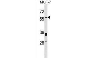 Western Blotting (WB) image for anti-Endogenous Retrovirus Group W, Member 1 (ERVW-1) antibody (ABIN2999163) (ERVW-1 anticorps)