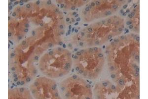 Detection of ADCY3 in Human Kidney Tissue using Polyclonal Antibody to Adenylate Cyclase 3 (ADCY3)