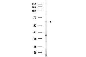 anti-Nucleolar Complex Associated 4 Homolog (NOC4L) (Internal Region) antibody