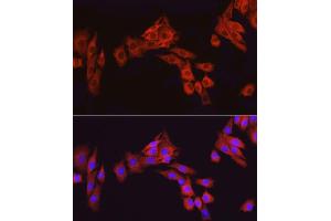 Immunofluorescence analysis of PC-12 cells using  Rabbit pAb (ABIN3020671, ABIN3020672, ABIN1512605 and ABIN6213659) at dilution of 1:100 (40x lens).