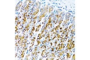 Immunohistochemistry of paraffin-embedded mouse stomach using C antibody (ABIN3021053, ABIN3021054, ABIN3021055 and ABIN6213930) at dilution of 1:100 (40x lens). (ACVR1C/ALK7 anticorps  (AA 22-113))