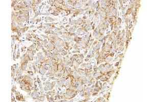 IHC-P Image Immunohistochemical analysis of paraffin-embedded A549 xenograft, using LIMCH1, antibody at 1:500 dilution.