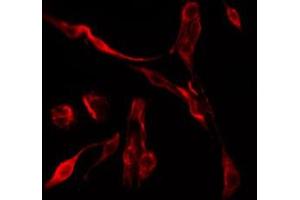ABIN6275005 staining HepG2 by IF/ICC. (CLIC6 anticorps  (Internal Region))