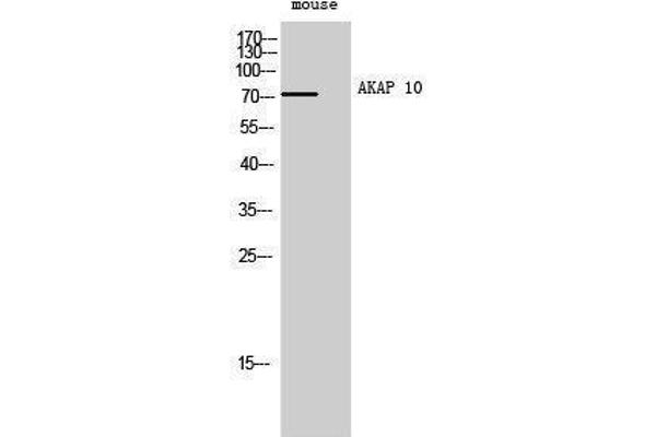 AKAP10 anticorps  (N-Term)