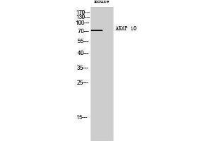 Western Blotting (WB) image for anti-A Kinase (PRKA) Anchor Protein 10 (AKAP10) (N-Term) antibody (ABIN3173722) (AKAP10 anticorps  (N-Term))