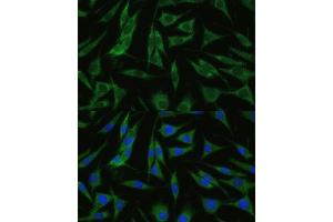 Immunofluorescence analysis of L929 cells using RHBDD1 Polyclonal Antibody (ABIN7269978) at dilution of 1:100 (40x lens). (RHBDD1 anticorps  (AA 206-315))