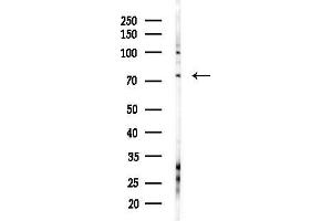 Western blot analysis of lysates from COLO205 cells(heat-shock,45 min treatment), using Kv1.