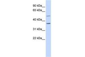 Image no. 1 for anti-Prostaglandin Reductase 2 (PTGR2) (AA 108-157) antibody (ABIN6741206) (PTGR2 anticorps  (AA 108-157))
