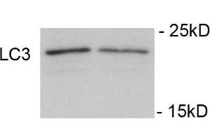 Immunoblots of SH-SY5Y cells treated with rapamycin for 1 h was probed with (ABIN389699 and ABIN2839660). (LC3C anticorps  (pSer12))