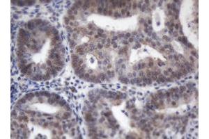 Image no. 2 for anti-Adrenocortical Dysplasia Homolog (ACD) antibody (ABIN1496406)