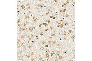 Immunohistochemistry of paraffin embedded mouse brain using UTS2 (ABIN7076162) at dilution of 1:2000 (400x lens) (Urotensin 2 anticorps)