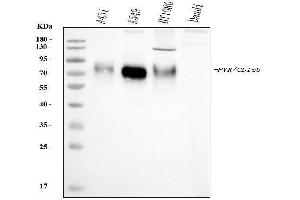 Western blot analysis of Poliovirus Receptor/PVR using anti-Poliovirus Receptor/PVR antibody (ABIN7601070).