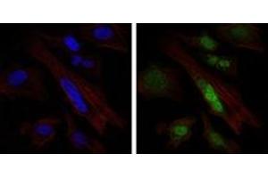 Immunofluorescence (IF) image for anti-SRY (Sex Determining Region Y)-Box 9 (SOX9) antibody (ABIN1109113)