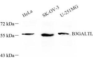 Western blot analysis of B3GALTL (ABIN7073206) at dilution of 1: 600 (B3GALTL anticorps)