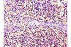 Immunohistochemistry of paraffin-embedded human tonsil tissue using ABIN7161178 at dilution of 1:100 (Nestin anticorps)