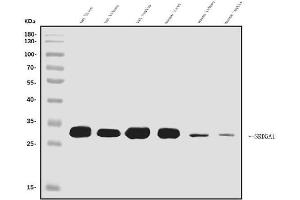 Western blot analysis of SRD5A1 using anti-SRD5A1 antibody (ABIN7601538).
