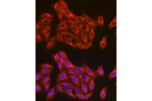 Immunofluorescence analysis of U-2 OS cells using β-Tubulin Rabbit pAb (ABIN3020552, ABIN3020553 and ABIN3020554) at dilution of 1:100 (40x lens). (TUBB anticorps  (AA 40-260))
