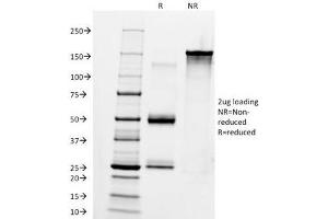 SDS-PAGE Analysis of Purified, BSA-Free Anti-IgM Antibody (clone IM260). (Souris anti-Humain IgM Anticorps)