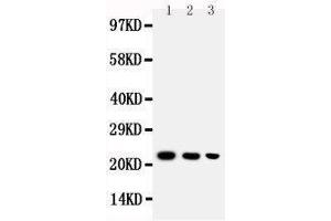 Anti-BAFF antibody, Western blotting Lane 1: Recombinant Human BAFF Protein 10ng Lane 2: Recombinant Human BAFF Protein 5ng Lane 3: Recombinant Human BAFF Protein 2. (BAFF anticorps  (C-Term))