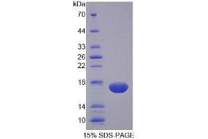 SDS-PAGE (SDS) image for Natural Cytotoxicity Triggering Receptor 3 (NCR3) (AA 21-147) protein (His tag) (ABIN6238885)