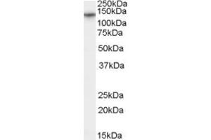 Western Blotting (WB) image for anti-Calcium Channel, Voltage-Dependent, alpha 2/delta Subunit 1 (CACNA2D1) (AA 370-383) antibody (ABIN295667) (CACNA2D1 anticorps  (AA 370-383))