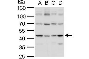 WB Image IDH1 antibody detects IDH1 protein by western blot analysis. (IDH1 anticorps  (Center))