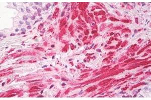 Image no. 2 for anti-Zinc Finger, CCHC Domain Containing 11 (ZCCHC11) (AA 1403-1452) antibody (ABIN6749768)