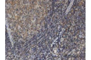 Immunoperoxidase of monoclonal antibody to EDC4 on formalin-fixed paraffin-embedded human tonsil. (EDC4 anticorps  (AA 1302-1401))