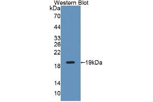 Western blot analysis of the recombinant protein. (INPP4A anticorps  (AA 1-137))