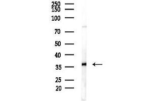 anti-NME Gene Family Member 9 (NME9) antibody