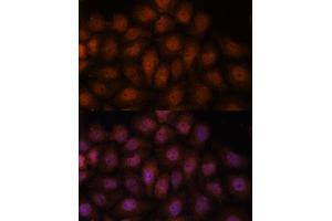 Immunofluorescence analysis of HeLa cells using IPO8 antibody (ABIN7267859) at dilution of 1:100. (Importin 8 anticorps  (AA 878-1037))
