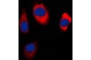 Immunofluorescent analysis of EDG5 staining in Hela cells. (S1PR2 anticorps  (C-Term))