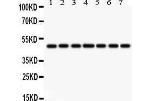 Western Blotting (WB) image for anti-Isocitrate Dehydrogenase 1 (NADP+), Soluble (IDH1) (AA 381-413), (C-Term) antibody (ABIN3043855)
