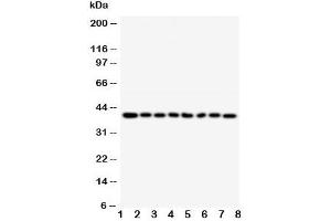 Western blot testing of PPID antibody and Lane 1:  rat brain