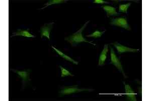Immunofluorescence of purified MaxPab antibody to BIRC5 on HeLa cell. (Survivin anticorps  (AA 1-142))
