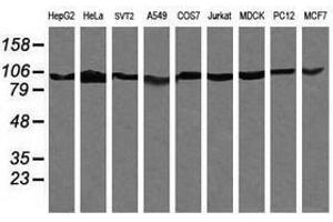 Image no. 5 for anti-Phosphoinositide-3-Kinase, Regulatory Subunit 5 (PIK3R5) antibody (ABIN1500211)
