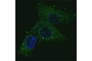 Fluorescent confocal image of HepG2 cells stained with MET antibody.