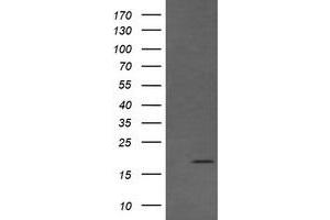 Image no. 1 for anti-Cancer/testis Antigen 1B (CTAG1B) antibody (ABIN1499907) (CTAG1B anticorps)