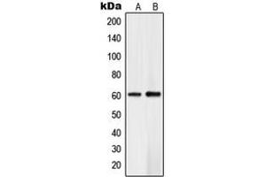 Western blot analysis of PLK5 expression in Jurkat (A), human brain (B) whole cell lysates. (PLK5 anticorps  (Center))