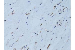 Immunohistochemistry of paraffin-embedded human breast using SELE Antibody.