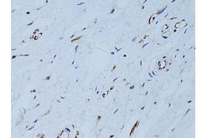 Immunohistochemistry of paraffin-embedded human breast using SELE Antibody. (Selectin E/CD62e anticorps  (AA 22-230))