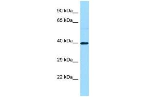 WB Suggested Anti-S1PR3 Antibody Titration: 1. (S1PR3 anticorps  (C-Term))