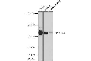 Western blot analysis of extracts of various cell lines, using PFKFB3 Rabbit mAb (ABIN1680620, ABIN3018306, ABIN3018307 and ABIN7101590) at 1:500 dilution. (PFKFB3 anticorps)