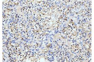 IHC analysis of ITCH/AIP4 using anti-ITCH/AIP4 antibody (ABIN7600263). (ITCH anticorps  (AA 17-358))