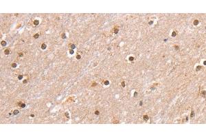 Immunohistochemistry of paraffin-embedded Human brain using SMARCB1 Polyclonal Antibody at dilution of 1:30