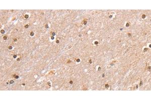 Immunohistochemistry of paraffin-embedded Human brain using SMARCB1 Polyclonal Antibody at dilution of 1:30 (SMARCB1 anticorps)