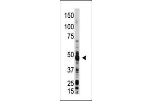 The anti-OAS1 Pab (ABIN390164 and ABIN2840661) is used in Western blot to detect OAS1 in mouse liver lysate.